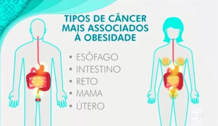 Leia mais sobre o artigo OBESIDADE E CÂNCER: ELES TÊM LIGAÇÃO?